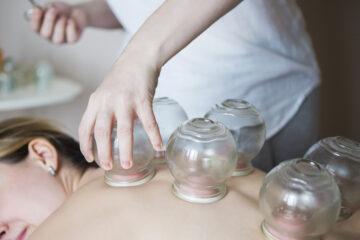 Cupping Therapy